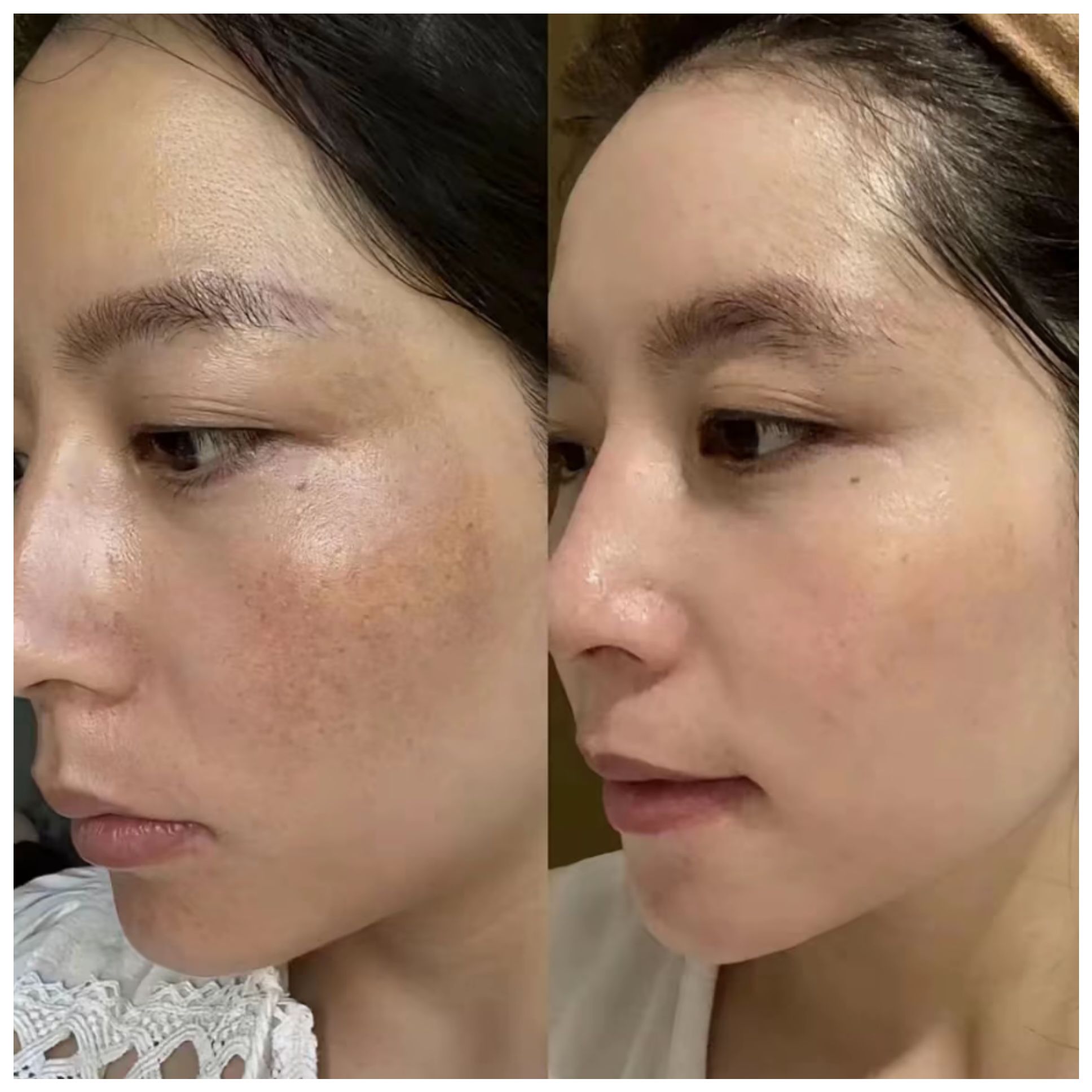 慕依颜素颜瓷肌调肤套效