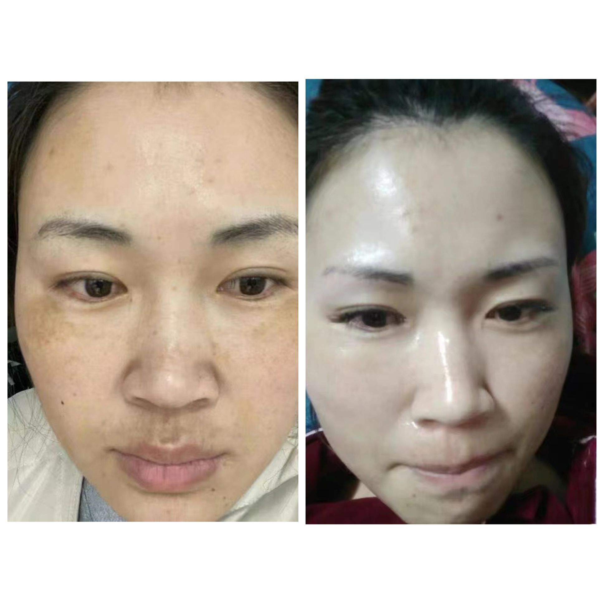 慕依颜7一15天美白提亮，