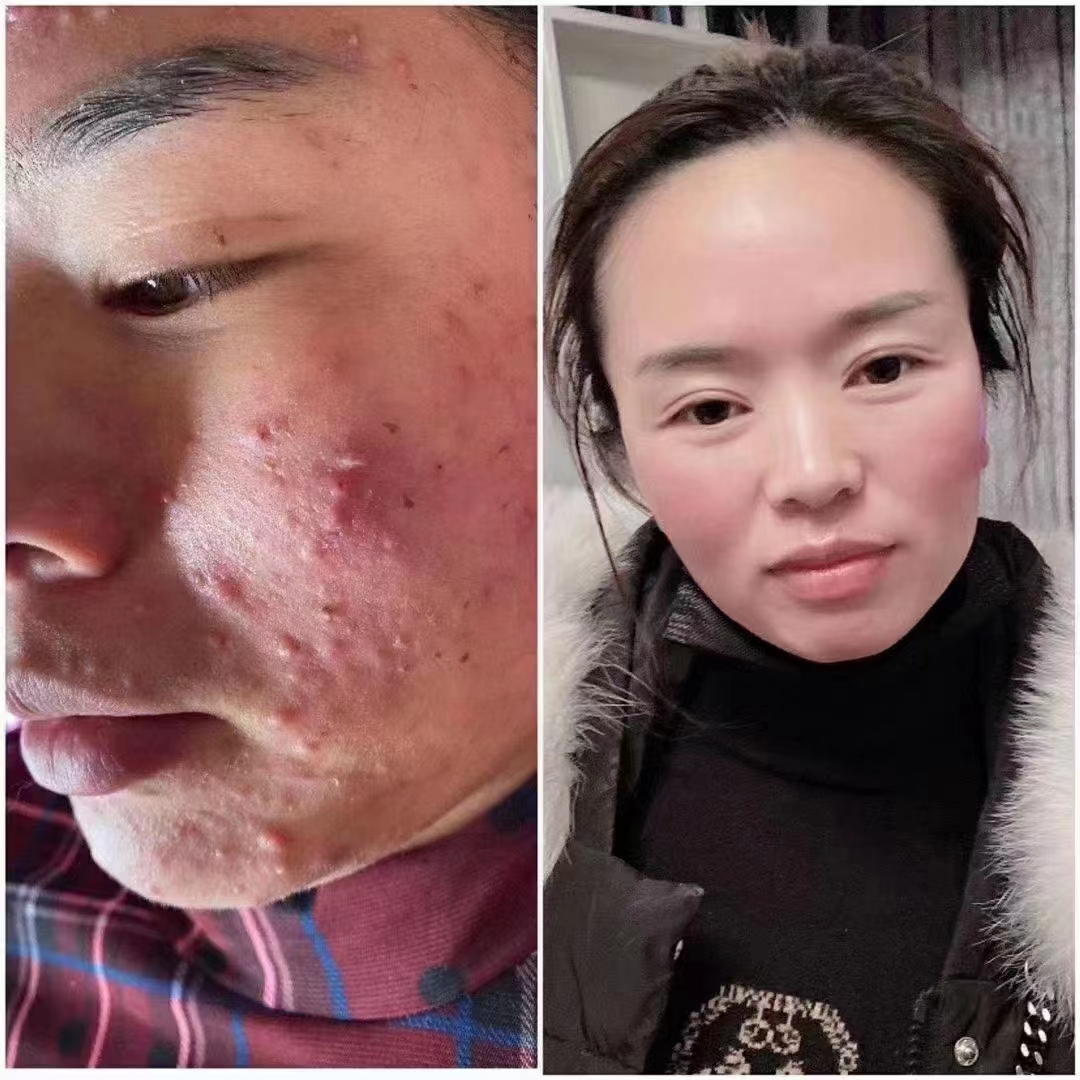 慕依颜签约调肤，无效全